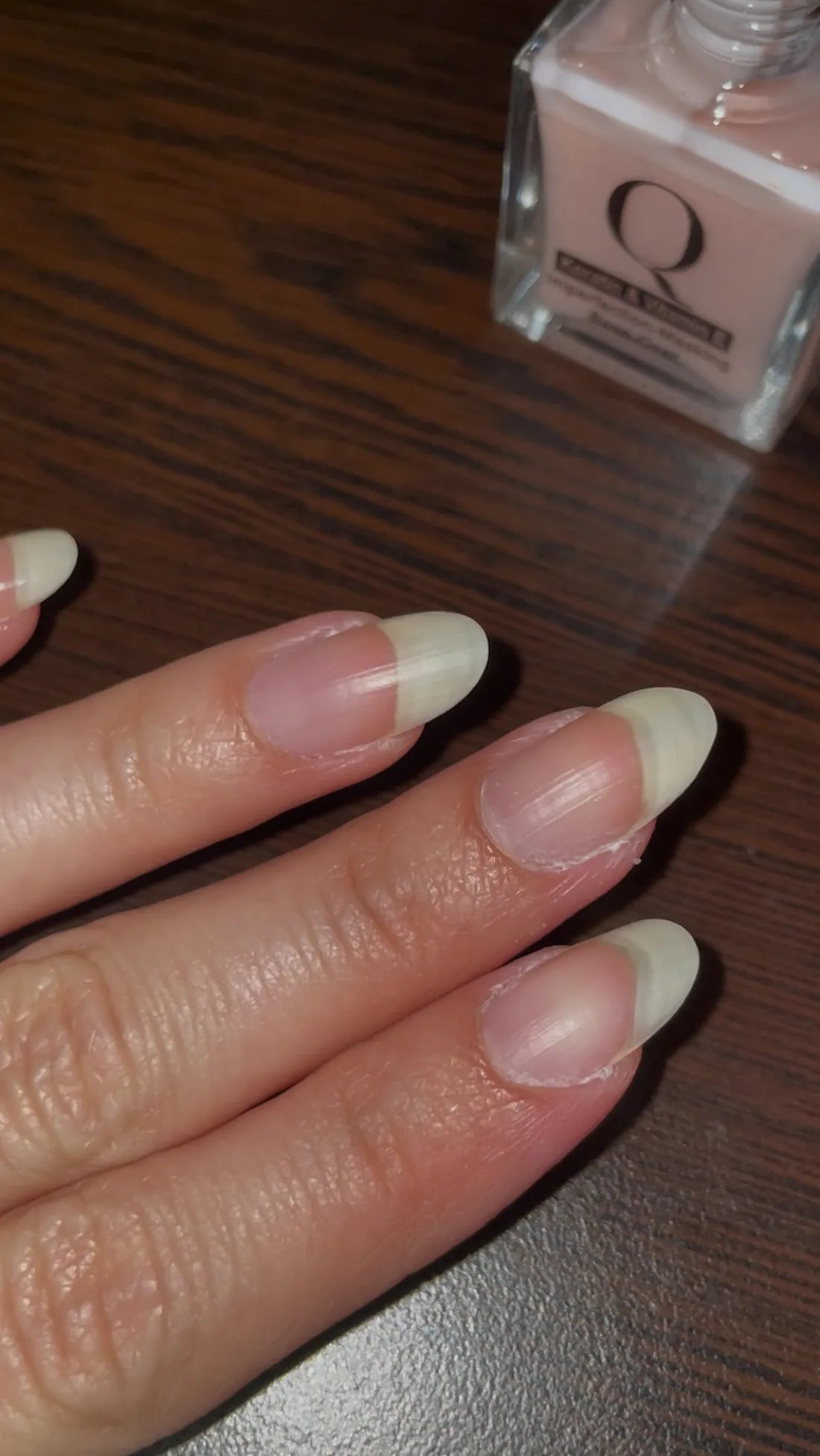 Bare natural nails before the base coat, showing surface ridges, peeling layers and uneven tone toward the tips
